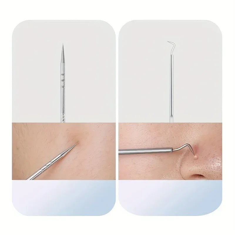 Stainless Steel Skin Care Treatment Tools Set