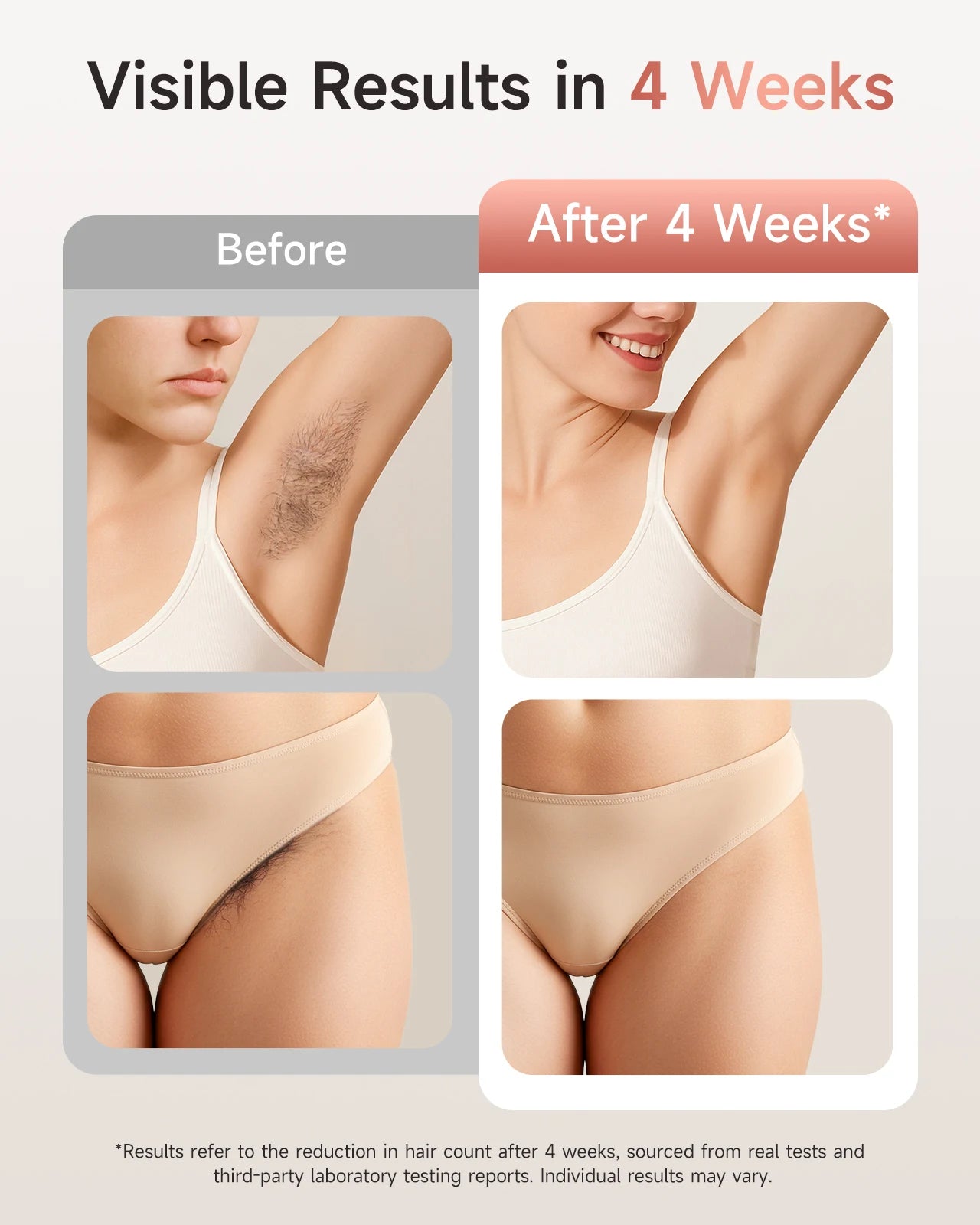 Lysmoski Ipl Hair Removal Device For Permanent Skin Rejuvenation Treatment