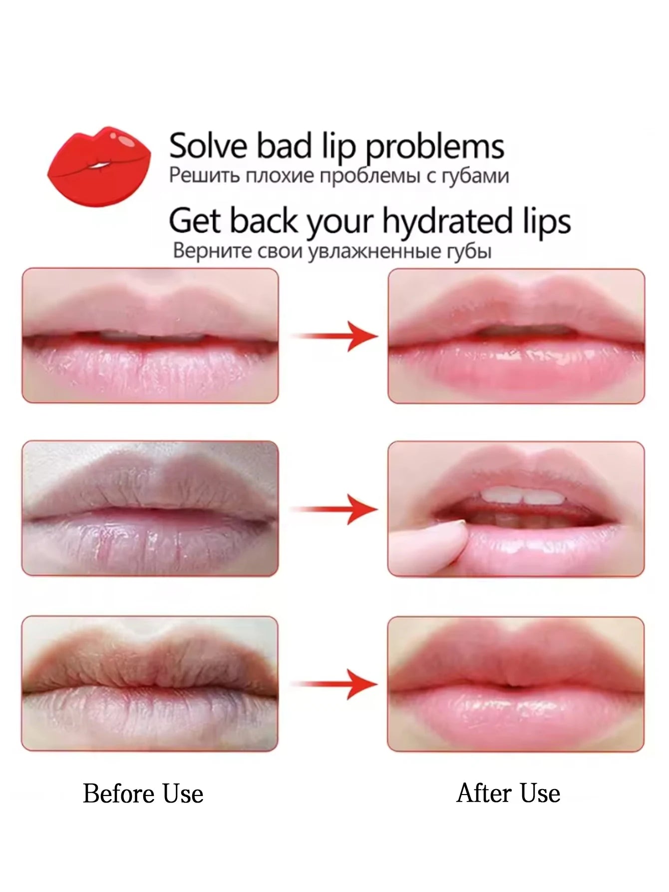 Yocity Cherry Collagen Jelly Lip Mask Patches For Deep Hydration