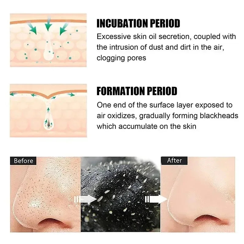 Suaqe Pore Cleansing Nasal Strips For Blackhead Removal