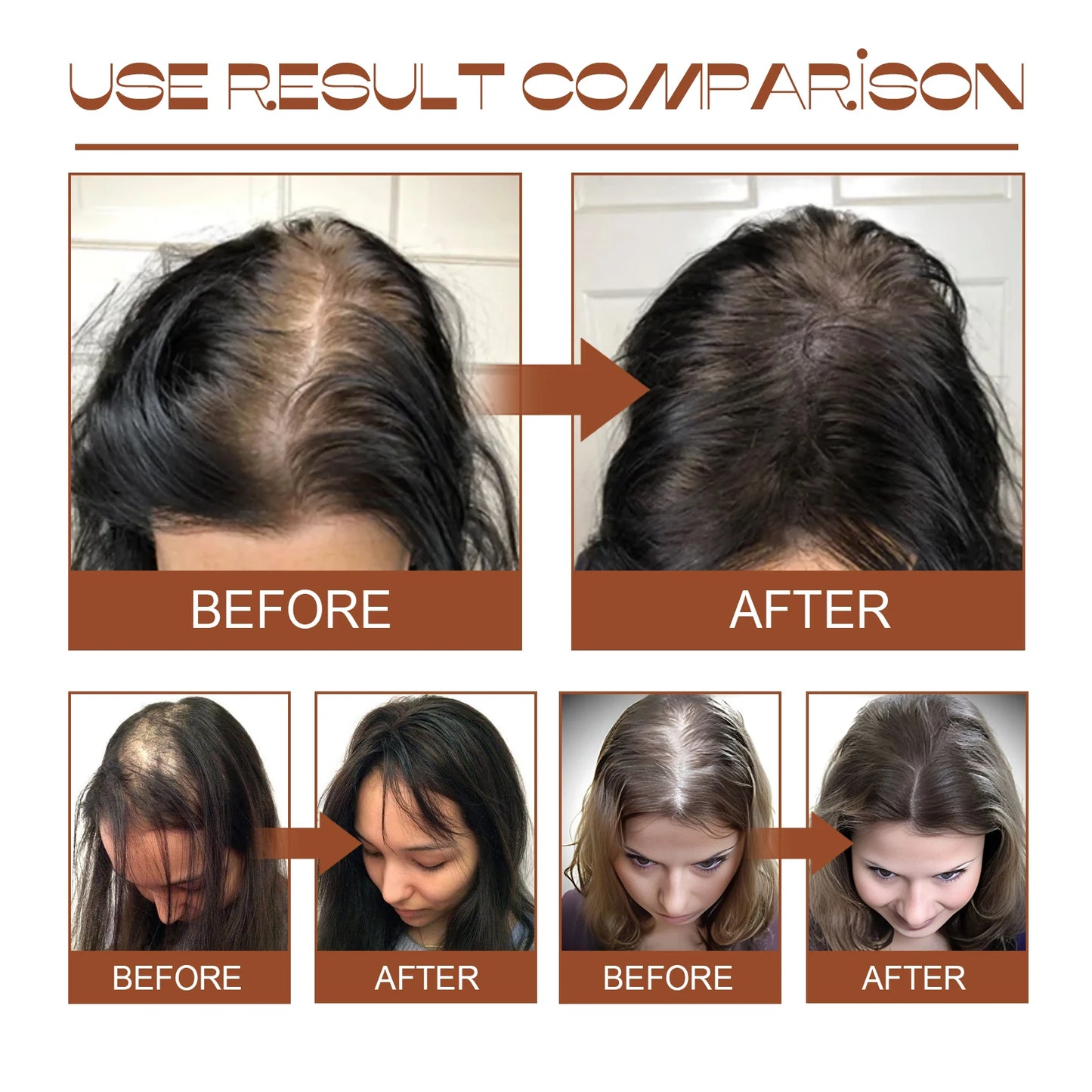 Eelhoe Batana Oil Hair Conditioner Smoothes And Repairs Damaged Hair