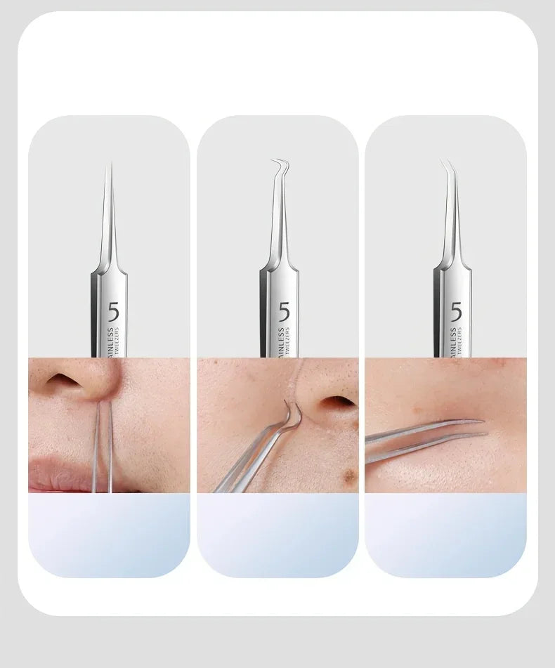 Stainless Steel Skin Care Treatment Tools Set
